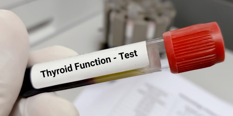 Treatment of Thyroid Swellings in raipur Treatment of Thyroid Swellings in raipur