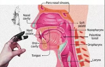 Recurrence of Oral cancer Recurrence of Oral cancer