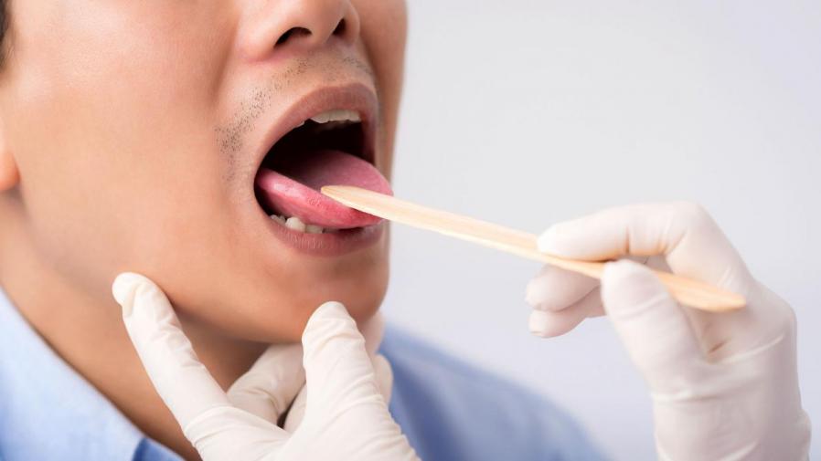 Image 8 oral examination 1.15secs Diagnosis of Oral Cancer