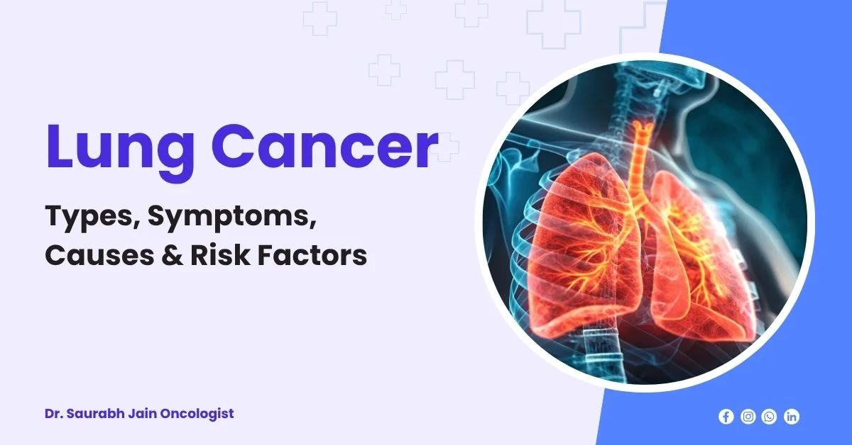 Lung Cancer - Types, Symptoms, Causes & Risk Factors